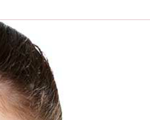 HCG Oral